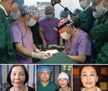 穆宝安提升效果怎么样,V美减龄维持十年不止