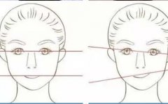 吴焱秋说眼：做双眼皮能调整“大小眼”吗!